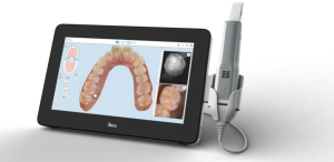 L'impatto positivo di iTero nell'ambito odontoiatrico